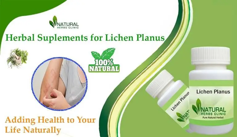 Herbal Supplement for Lichen Planus